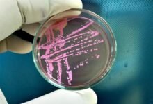 Shigella | Virulent bacterium