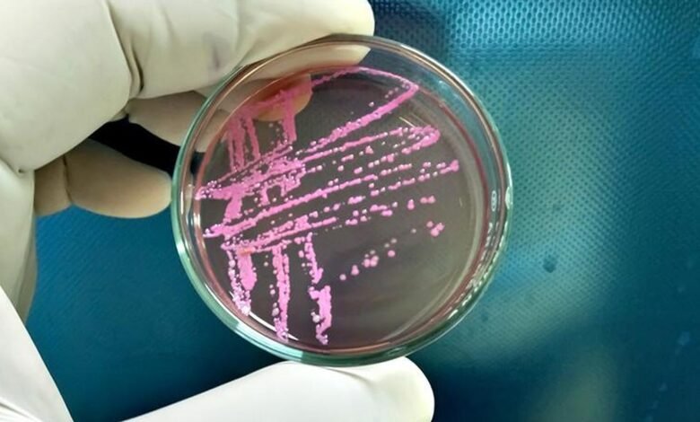 Shigella | Virulent bacterium